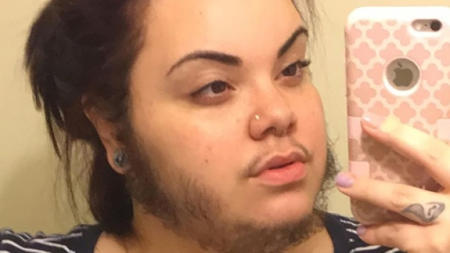 Usa, ragazza con la barba invitata a suicidarsi