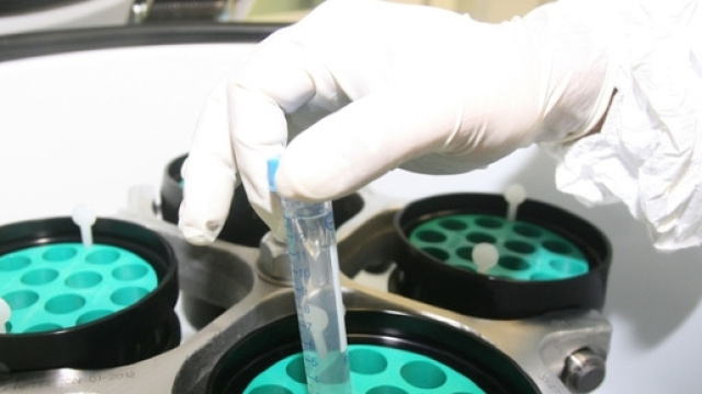 Possiamo 'affamare' i tumori con la dieta