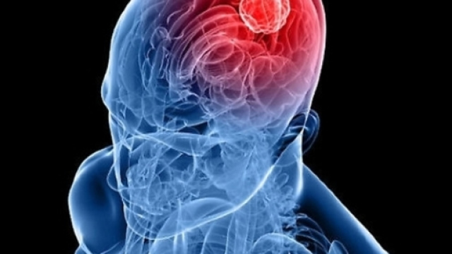 10 consigli per far un buon uso del cellulare e ridurre il rischio tumore