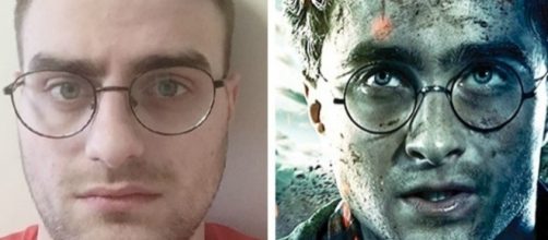 O jovem russo Nikolai, que &eacute; s&oacute;sia de Daniel Radcliffe