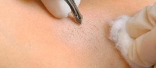 Segundo a pesquisa, homens e mulheres preferem o mesmo tipo de depila&ccedil;&atilde;o