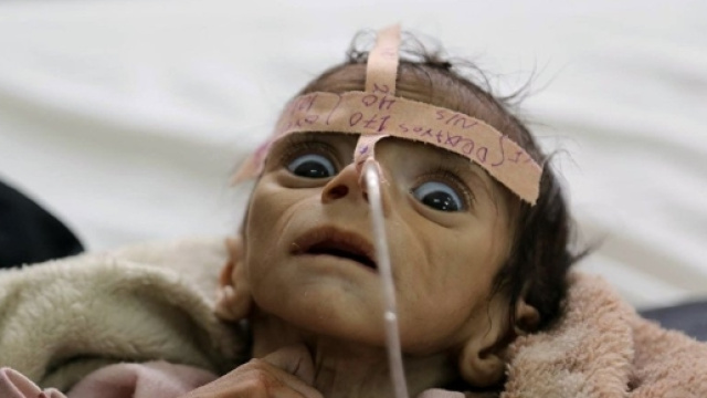 Y&eacute;men: un enfant mort de faim, symbole de l'indiff&eacute;rence g&eacute;n&eacute;rale - sputniknews.com