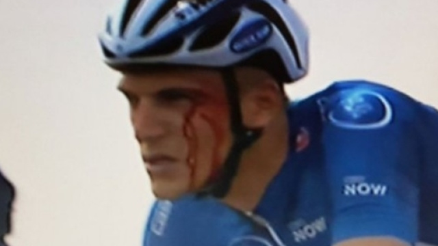 Marcel Kittel dopo il pugno preso da Grivko