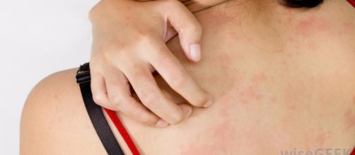 Veja quais s&atilde;o os tipos mais comuns de coceiras