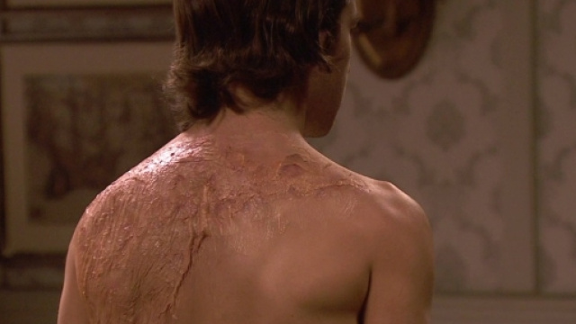 Il Segreto, ecco chi &egrave; Damian, l'uomo dalle misteriose cicatrici