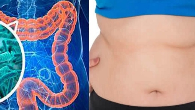 Non riesci a dimagrire? Colpa di un microbiota.