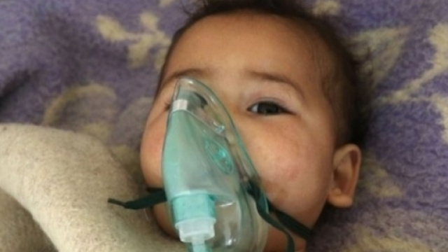 I drammatici effetti sui bambini delle armi chimiche usate in Siria