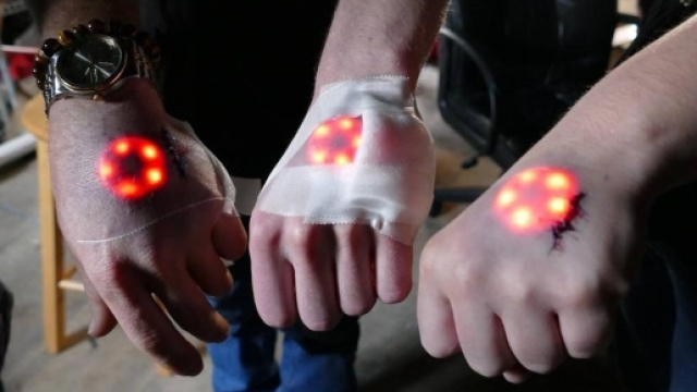 Svezia: microchip sottopelle a dipendenti di un'azienda - vice.com