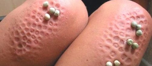 O medo de buracos conhecido como Tripofobia