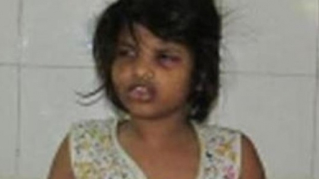 le condizioni della bimba trovata nella foresta