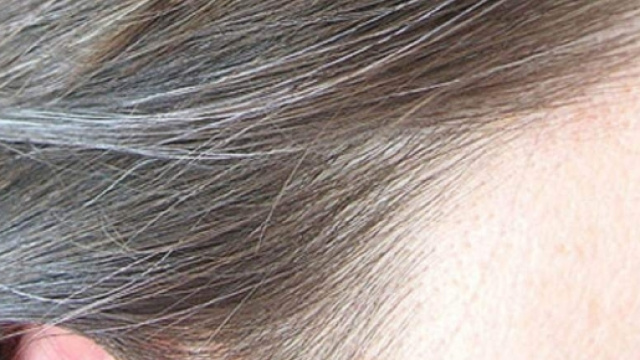 Scoperta la causa dei capelli bianchi e della calvizie