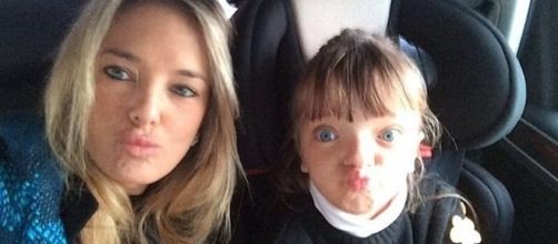 Filha de Ticiane &eacute; portadora de estenose cranio-facial.
