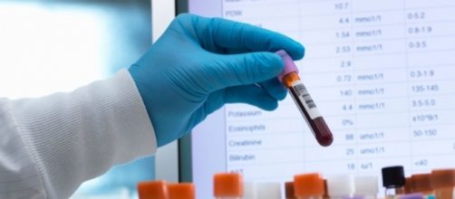 Hepatitis C infections tripled in five years | News OK - newsok.com