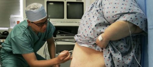 Weight-loss surgery linked to reduced depression, study shows - LA ... - latimes.com