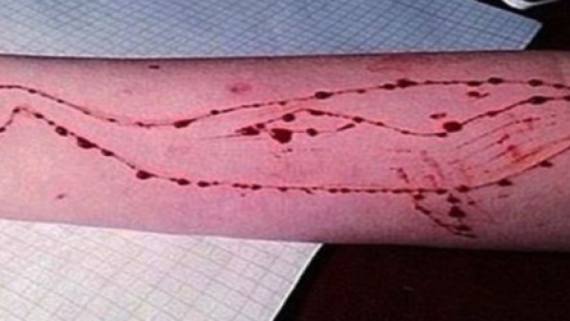 Una delle regole impone di incidersi una balenottera azzurra