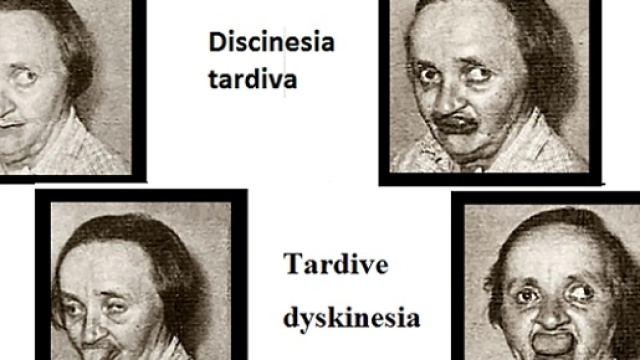 Finalmente arrivano i primi farmaci per controllare questo disturbo di origine iatrogeno.