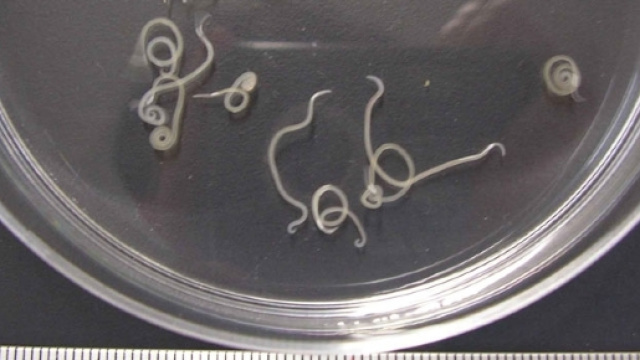 Sushi, anisakis: dov'&egrave;, come evitarlo | Velvet Body Italia - velvetbody.it