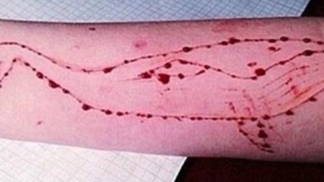Il tatuaggio della Blue whale inciso sul braccio, 11ma regola del gioco