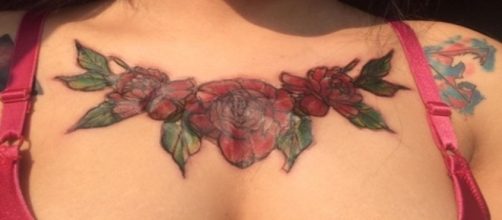 Mulher remove tatuagem usando produto qu&iacute;mico