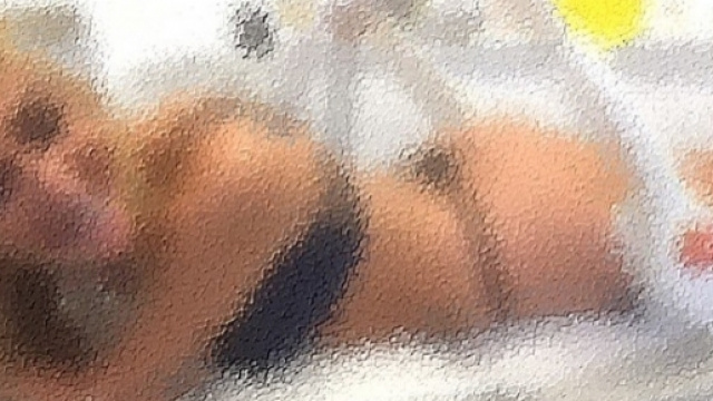 M&eacute;laniie (Les Anges 9) tente une nouvelle chirurgie esth&eacute;tique