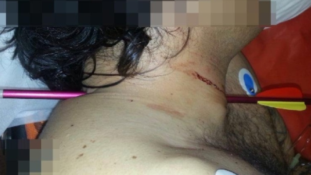 Choc a Torino, pulisce la balestra e si trafigge il collo con un dardo - adnkronos.com