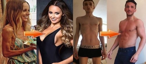 Casos de pessoas que venceram a anorexia