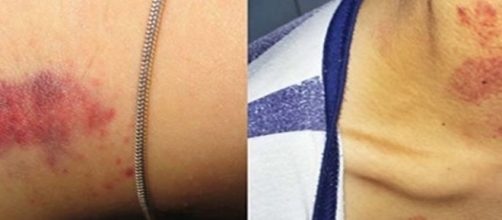 O chup&atilde;o pode causar grandes problemas.