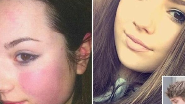 A sinistra il selfie che Emily Drouet ,18 anni, percossa dal fidanzato (a destra) si &egrave; fatta prima di uccidersi.