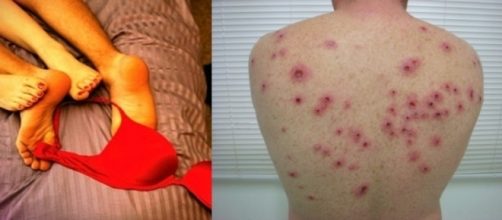 S&iacute;filis est&aacute; de volta com grande impacto, agora na vers&atilde;o Epidemia