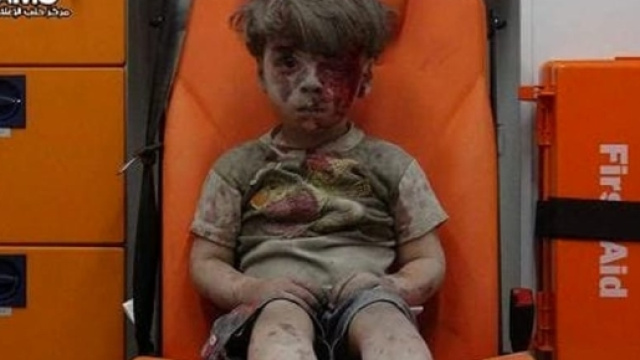Siria, Aleppo: bambino ferito nei bombardamenti | Foto e Video - today.it