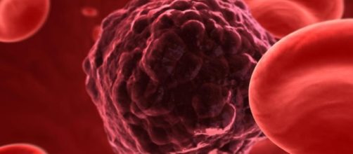 Entenda o c&acirc;ncer e algumas sintomas da doen&ccedil;a