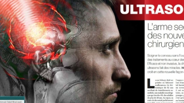Ultrasons : l'arme secr&egrave;te des nouveaux chirurgiens - Science-et ... - science-et-vie.com