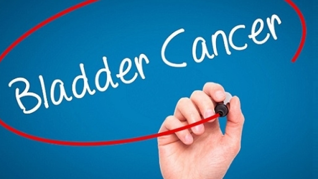 Nei casi recidivanti e pi&ugrave; avanzati di carcinoma uroteliale ora &egrave; disponibile un nuovo farmaco, un anticorpo monoclonale anti PD-L1.