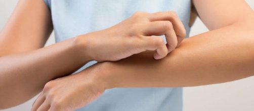 How To Get Rid Of Molluscum Contagiosum? Home Remedies For ... - liveitbeautiful.com