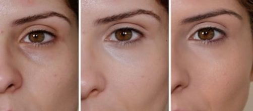 Saiba como disfar&ccedil;ar as olheiras (Foto: Reprodu&ccedil;&atilde;o)