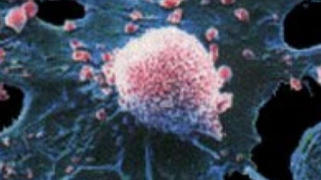 Scoperto l'interruttore del cancro