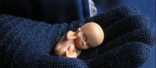 pro-life | by Ondřej P. Vaněček flickr