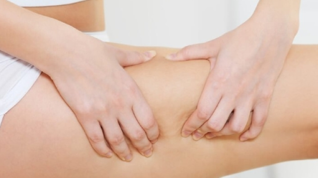 Rimedio naturale contro la cellulite, bastano due ingredienti!