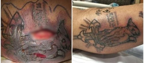 Homem morre ap&oacute;s contrair bact&eacute;ria