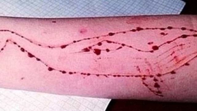 Blu Whale, il folle gioco del suicidio a Milano? Quattro casi sospetti - milanotoday.it