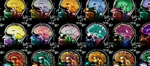 Study Identifies the Brain Parts and Functions Involved in Dreaming -