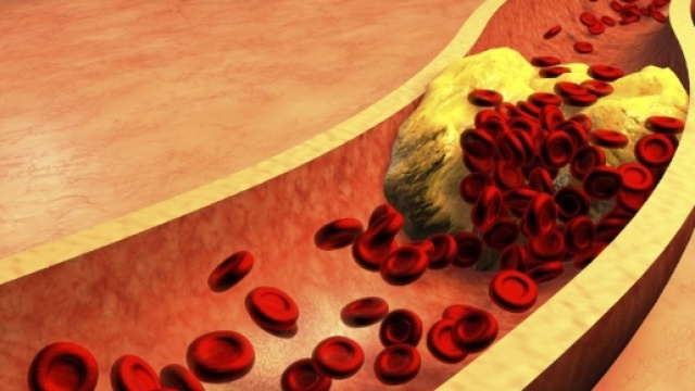 Allo studio un vaccino anti-colesterolo che potrebbe "mandare in ... - blogspot.com