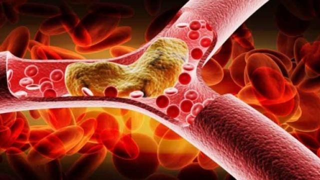 Vaccino anti colesterolo cattivo