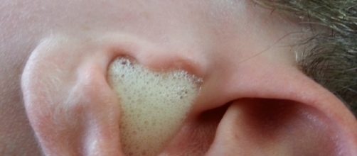 Livre de maneira f&aacute;cil da cera de ouvido