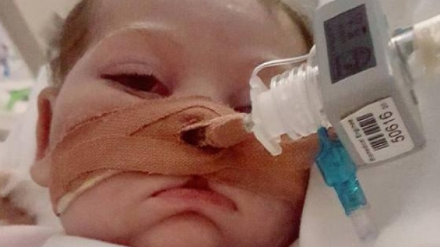 Il piccolo Charlie Gard &egrave; morto