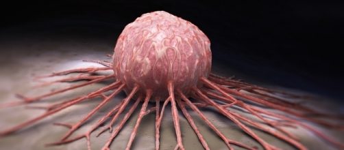 El secreto sobre el c&aacute;ncer que ha sido revelado - Vida L&uacute;cida - lavidalucida.com