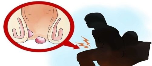 A taxa de cura do vaginismo &eacute; muito alta. (Foto reprodu&ccedil;&atilde;o/Wikihow)