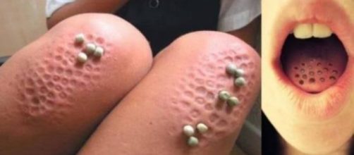 Teste para saber se voc&ecirc; tem tripofobia