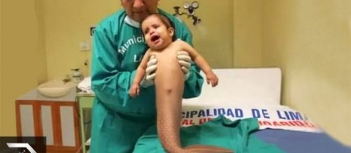 Crian&ccedil;as que nasceram com doen&ccedil;as raras