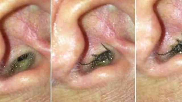 Forte mal di testa: la raccapricciante motivazione